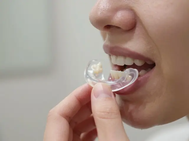 Opalescence bělení: Jak dosáhnout bělejších zubů bez bolesti a s trvalým efektem