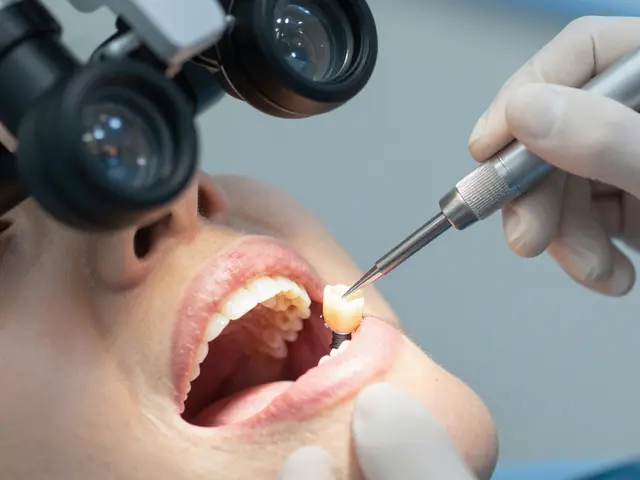 Broušení zubů: Jak přesně pomáhá při léčení zubních implantátů