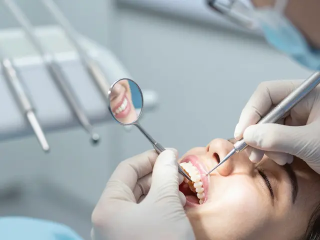 Jak dlouho vydrží veneers zuby? Všechno, co potřebujete vědět o trvanlivosti zubních veneers