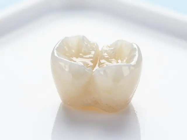 Jak dlouho vydrží Mustek a co ovlivňuje životnost keramických zubů