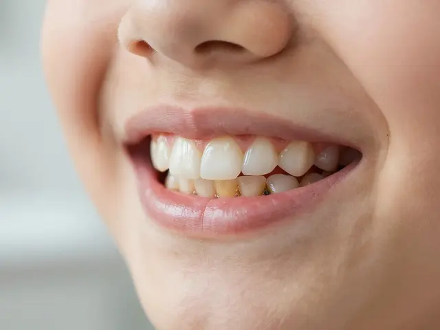 Zubní kámen u dětí: Proč nením chtít a jak mu předíst