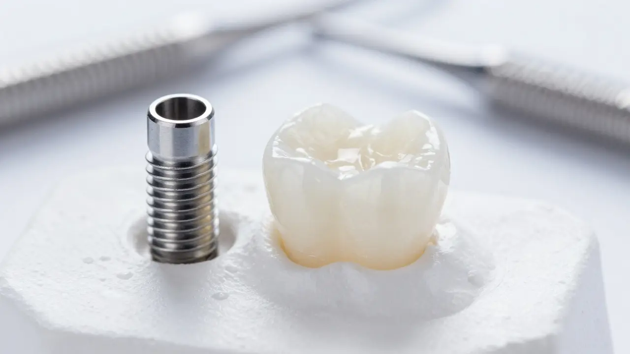 Detailní záběr zirkonové korunky a zubního implantátu na sterilním podkladu