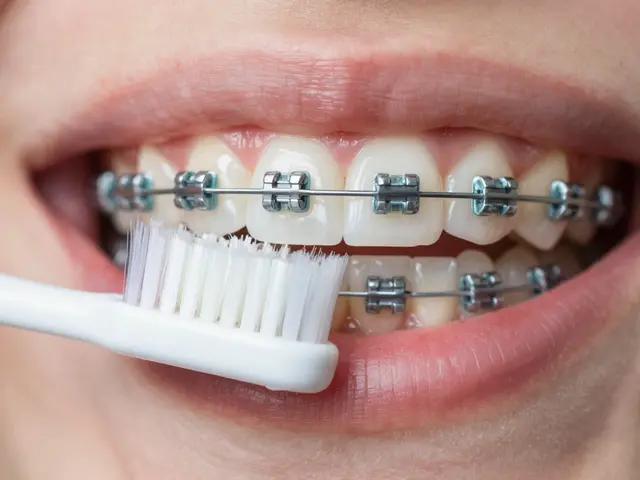 Keramické rovnátka a ústní hygiena: Kompletní průvodce pro čistý úsměv