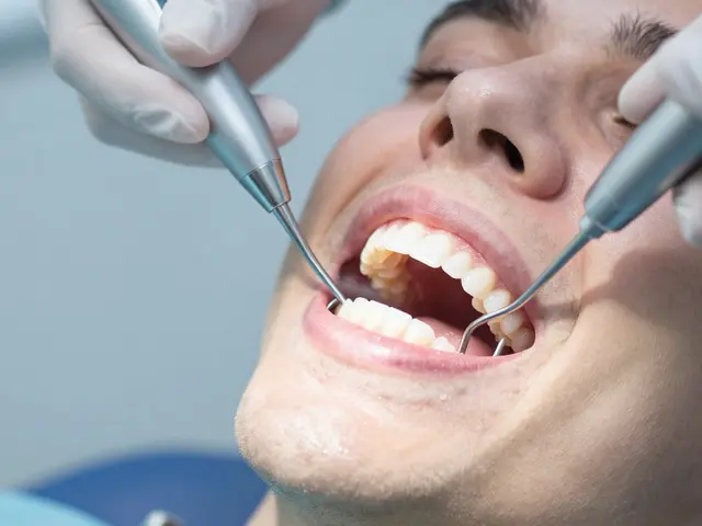 Jaká je bolestivost kyretáže zubů? Skutečný průběh a tipy